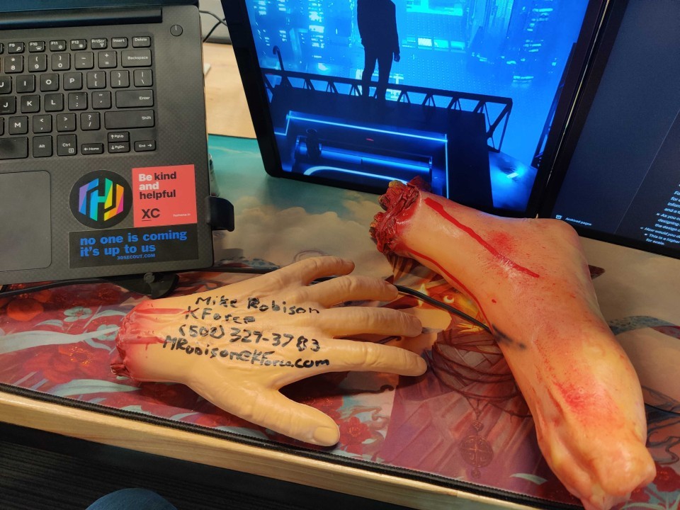 He Gave Me a Severed Hand With His Contact Information on It. Let Me Explain...